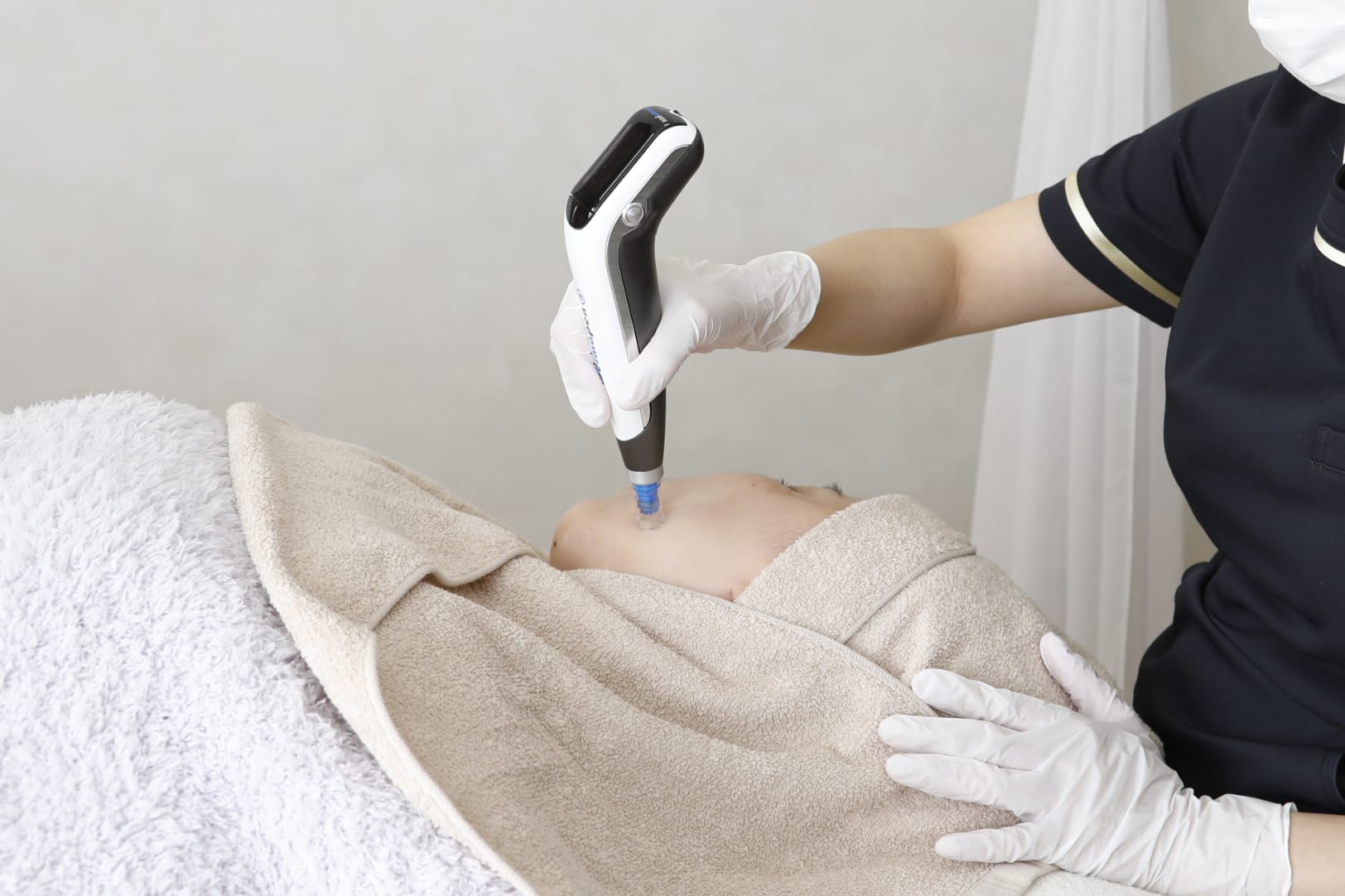 ダーマペン4とは