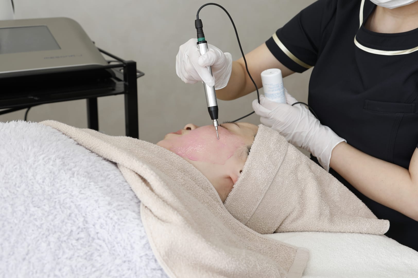 メソナJのポイント