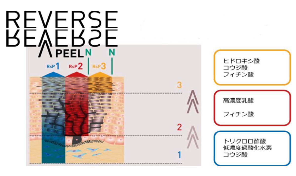 リバースピールのポイント