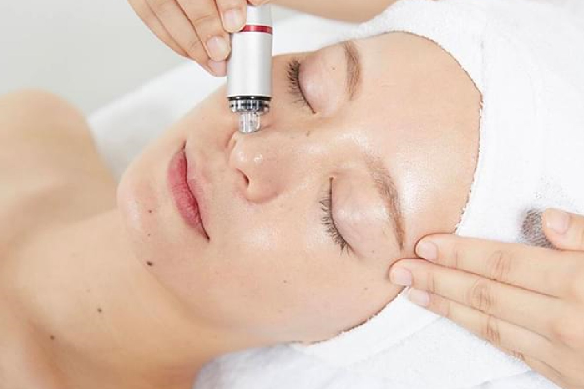 ハイドラピーリングの特徴