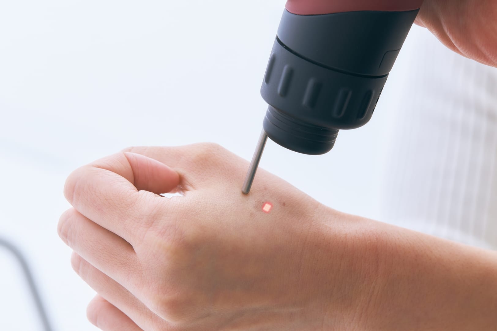 Qスイッチルビーレーザーとは